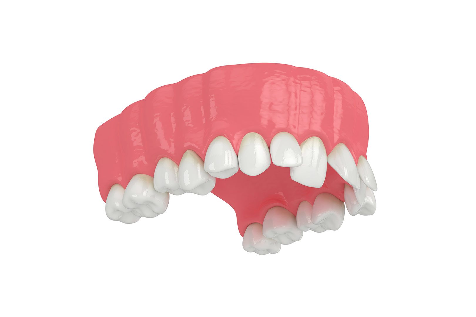 Orthodontics Service Leduc | Prairie Dental | General & Family Dentist | Leduc, AB