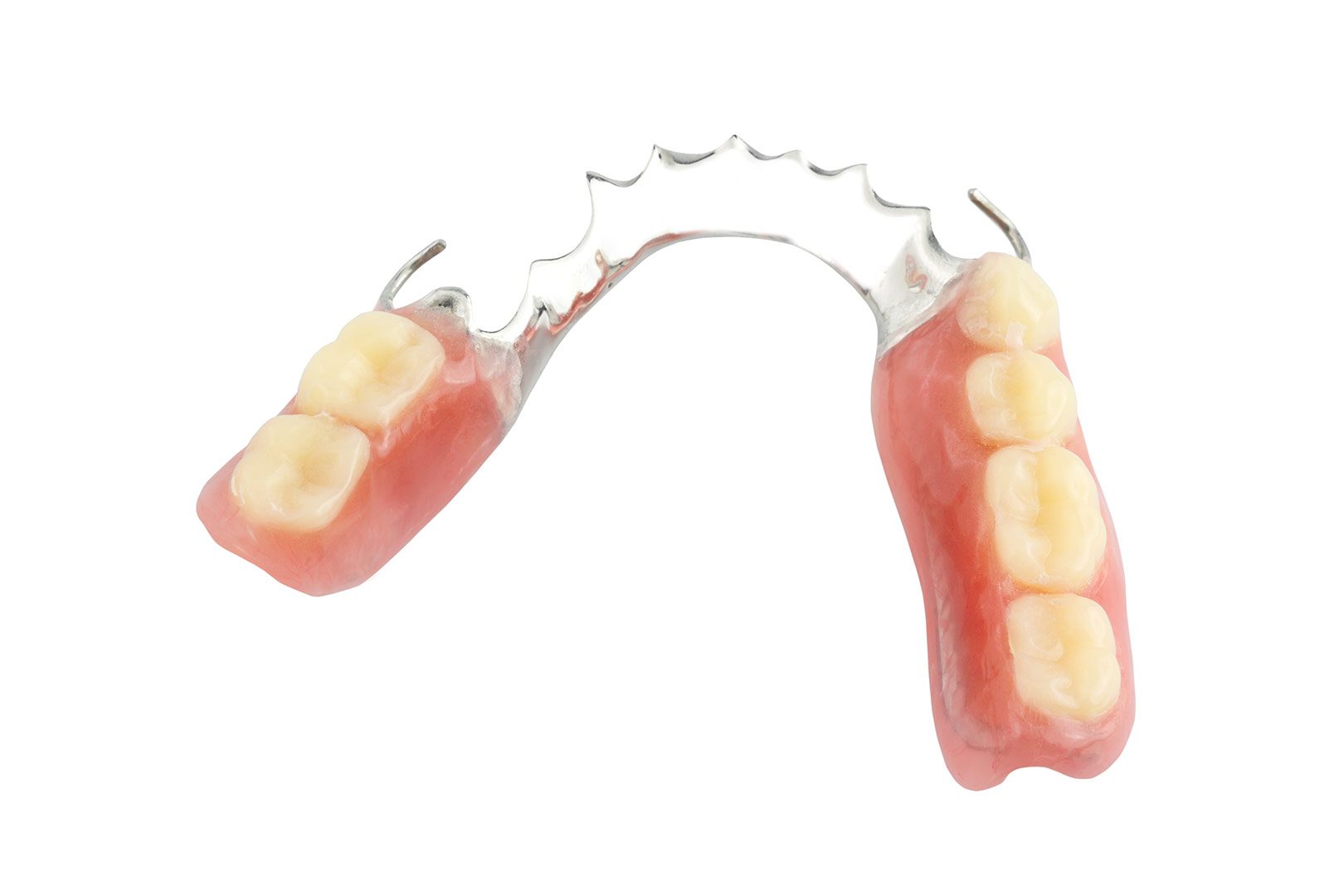 Partial dentures | Prairie Dental | General & Family Dentist | Leduc, AB