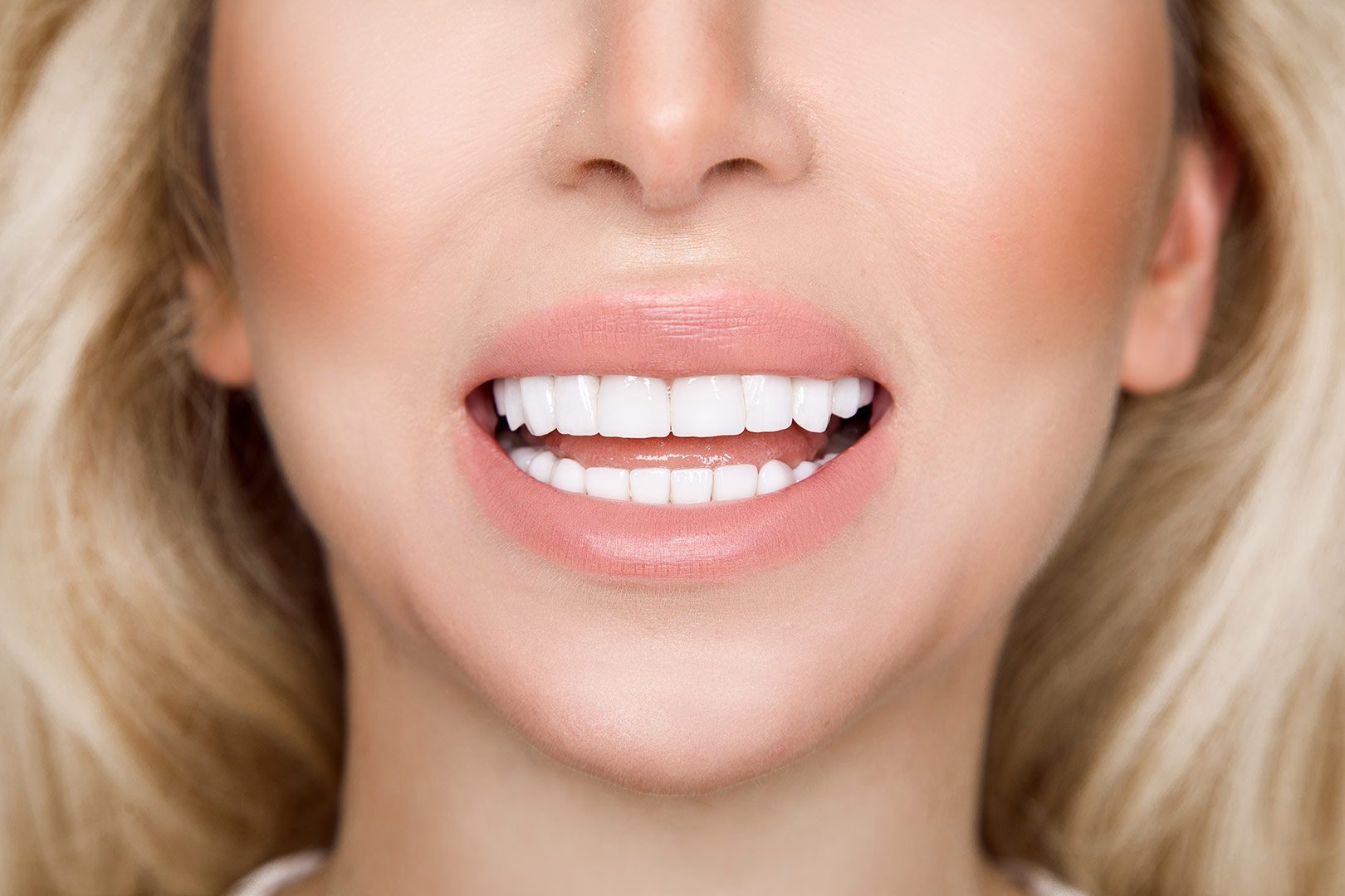 Leduc Porcelain Veneers | Prairie Dental | General & Family Dentist | Leduc, AB